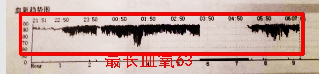 呼吸机使用纪实:只希望他晚上睡得更好一些!