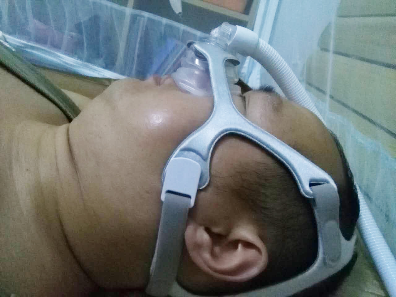 独家:详解面罩漏气(二)我怎么知道面罩正在漏气?