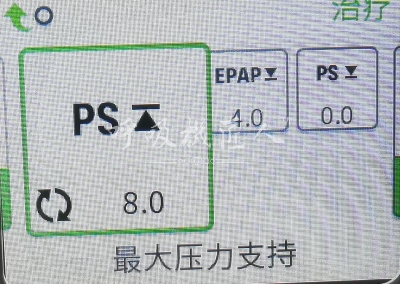 双水平全自动呼吸机介绍